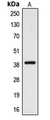 CYSLT2 / CYSLTR2 Antibody - Western blot analysis of CYSLTR2 expression in A10 (A) whole cell lysates.