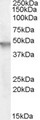 CYTH2 / Cytohesin 2 Antibody - Antibody (0.5 ug/ml) staining of Human Brain (Cerebellum) lysate (35 ug protein in RIPA buffer). Primary incubation was 1 hour. Detected by chemiluminescence.