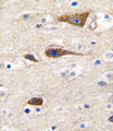Cytochrome P450 2R1 / CYP2R1 Antibody - Formalin-fixed and paraffin-embedded human brain tissue reacted with CYP2R1 antibody , which was peroxidase-conjugated to the secondary antibody, followed by DAB staining. This data demonstrates the use of this antibody for immunohistochemistry; clinical relevance has not been evaluated.