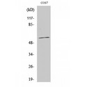 Cytochrome P450 CYP1A1/2 Antibody - Western blot of CYP1A1/2 antibody
