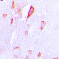 Antibody - Immunohistochemical analysis of Cytochrome P450 1A1/2 staining in human brain formalin fixed paraffin embedded tissue section. The section was pre-treated using heat mediated antigen retrieval with sodium citrate buffer (pH 6.0). The section was then incubated with the antibody at room temperature and detected using an HRP conjugated compact polymer system. DAB was used as the chromogen. The section was then counterstained with hematoxylin and mounted with DPX.
