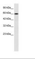 DACH2 Antibody - Jurkat Cell Lysate.  This image was taken for the unconjugated form of this product. Other forms have not been tested.