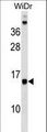 DAD1 Antibody - DAD1 Antibody western blot of WiDr cell line lysates (35 ug/lane). The DAD1 antibody detected the DAD1 protein (arrow).