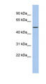 DALRD3 Antibody - DALRD3 antibody Western blot of HepG2 cell lysate. This image was taken for the unconjugated form of this product. Other forms have not been tested.