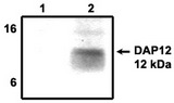 DAP12 Antibody - Immunoprecipitation using DAP12 antibody on MHC class I (1) and NKp44 (2) positive cells.
