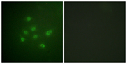 DAPK3 / ZIP Kinase Antibody - Immunofluorescence analysis of A549 cells, using DAPK3 (Phospho-Thr265) Antibody. The picture on the right is blocked with the phospho peptide.