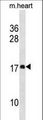 DAPL1 Antibody - DAPL1 Antibody western blot of mouse heart tissue lysates (35 ug/lane). The DAPL1 antibody detected the DAPL1 protein (arrow).