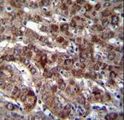 DARS Antibody - DARS Antibody immunohistochemistry of formalin-fixed and paraffin-embedded human liver tissue followed by peroxidase-conjugated secondary antibody and DAB staining.
