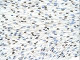 DAZAP1 Antibody - DAZAP1 antibody ARP40927_T100-NP_061832-DAZAP1 (DAZ associated protein 1) Antibody was used in IHC to stain formalin-fixed, paraffin-embedded human heart.  This image was taken for the unconjugated form of this product. Other forms have not been tested.