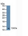 DBI / ACBD1 Antibody