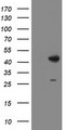 DBT / E2 Antibody - HEK293T cells were transfected with the pCMV6-ENTRY control (Left lane) or pCMV6-ENTRY DBT (Right lane) cDNA for 48 hrs and lysed. Equivalent amounts of cell lysates (5 ug per lane) were separated by SDS-PAGE and immunoblotted with anti-DBT.