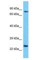 DCAF16 Antibody - DCAF16 antibody Western Blot of HepG2. Antibody dilution: 1 ug/ml.  This image was taken for the unconjugated form of this product. Other forms have not been tested.