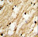 DCC1 / DSCC1 Antibody - Formalin-fixed and paraffin-embedded human brain tissue with DCC1 Antibody , which was peroxidase-conjugated to the secondary antibody, followed by DAB staining. This data demonstrates the use of this antibody for immunohistochemistry; clinical relevance has not been evaluated.