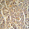 DCD / Dermcidin Antibody - DCD Antibody (RB18706) IHC of formalin-fixed and paraffin-embedded human skin tissue followed by peroxidase-conjugated secondary antibody and DAB staining.
