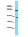 DCDC2B Antibody - DCDC2B antibody Western Blot of HeLa. Antibody dilution: 1 ug/ml.  This image was taken for the unconjugated form of this product. Other forms have not been tested.