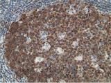 DCK / Deoxycytidine kinase Antibody - IHC of paraffin-embedded Human lymph node tissue using anti-DCK mouse monoclonal antibody.