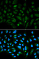 DCN / Decorin Antibody - Immunofluorescence analysis of MCF-7 cells using DCN antibody. Blue: DAPI for nuclear staining.