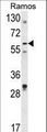 DCP1B Antibody - Western blot of DCP1B Antibody in Ramos cell line lysates (35 ug/lane). DCP1B (arrow) was detected using the purified antibody.