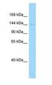 DCTN1 / Dynactin 1 Antibody - DCTN1 antibody Western Blot of Rat Thymus.  This image was taken for the unconjugated form of this product. Other forms have not been tested.
