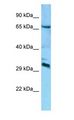 DCUN1D4 Antibody - DCUN1D4 antibody Western Blot of Mouse Brain.  This image was taken for the unconjugated form of this product. Other forms have not been tested.