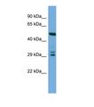 DCUN1D4 Antibody - Western blot of Human HepG2. DCUN1D4 antibody dilution 1.0 ug/ml.  This image was taken for the unconjugated form of this product. Other forms have not been tested.