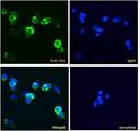 DCX / Doublecortin Antibody - DCX / Doublecortin antibody immunofluorescence analysis of paraformaldehyde fixed HepG2 cells, permeabilized with 0.15% Triton. Primary incubation 1hr (5ug/ml) followed by Alexa Fluor 488 secondary antibody (1ug/ml), showing cytoplasmic staining. The nuclear stain is DAPI (blue). Negative control: Unimmunized goat IgG (10ug/ml) followed by Alexa Fluor 488 secondary antibody (2ug/ml).