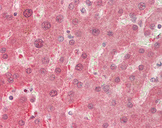 DDH / AKR1C1 Antibody - Human Liver: Formalin-Fixed, Paraffin-Embedded (FFPE).  This image was taken for the unconjugated form of this product. Other forms have not been tested.