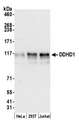 DDHD1 Antibody - Detection of human DDHD1 by western blot. Samples: Whole cell lysate (15 µg) from HeLa, HEK293T, and Jurkat cells prepared using NETN lysis buffer. Antibody: Affinity purified rabbit anti-DDHD1 antibody used for WB at 1:1000. Detection: Chemiluminescence with an exposure time of 30 seconds.