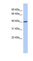 DDI1 Antibody - DDI1 antibody Western blot of Placenta lysate. This image was taken for the unconjugated form of this product. Other forms have not been tested.