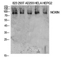 DDIAS Antibody - Western Blot analysis of extracts from 823, 293T, AD293, Hela, HepG2 cells using NOXIN Antibody.