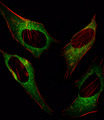 DDIT3 / CHOP Antibody - Fluorescent image of HeLa cell stained with DDIT3 Antibody (C-term A135). HeLa cells were fixed with 4% PFA (20 min), permeabilized with Triton X-100 (0.1%, 10 min), then incubated with DDIT3 primary antibody (1:25, 1 h at 37°C). For secondary antibody, Alexa Fluor 488 conjugated donkey anti-rabbit antibody (green) was used (1:400, 50 min at 37°C). Cytoplasmic actin was counterstained with Alexa Fluor 555 (red) conjugated Phalloidin (7units/ml, 1 h at 37°C). DDIT3 immunoreactivity is localized to Cytoplasm significantly.