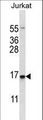 DDIT3 / CHOP Antibody - DDIT3 Antibody western blot of Jurkat cell line lysates (35 ug/lane). The DDIT3 antibody detected the DDIT3 protein (arrow).