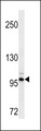 DDR2 Antibody - DDR2 Antibody western blot of HepG2 cell line lysates (35 ug/lane). The DDR2 antibody detected the DDR2 protein (arrow).