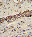 DDR2 Antibody - Formalin-fixed and paraffin-embedded human normal lung with TYRO10 Antibody, which was peroxidase-conjugated to the secondary antibody, followed by DAB staining. This data demonstrates the use of this antibody for immunohistochemistry; clinical relevance has not been evaluated.