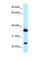 DDX / AKR1C3 Antibody - AKR1C3 antibody Western blot of COL0205 Cell lysate. Antibody concentration 1 ug/ml.  This image was taken for the unconjugated form of this product. Other forms have not been tested.