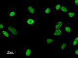 DDX17 Antibody - Immunostaining analysis in HeLa cells. HeLa cells were fixed with 4% paraformaldehyde and permeabilized with 0.1% Triton X-100 in PBS. The cells were immunostained with anti-DDX17 mAb.
