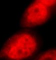 DDX17 Antibody - Immunofluorescence microscopy. Rabbit anti-DDX17 was used at a 1:25 dilution to stain HeLa cells with Rhodamine-labeled Goat anti-rabbit IgG (red).