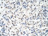 DDX19B Antibody - DDX19B antibody ARP40300_T100-NP_009173-DDX19B (DEAD (Asp-Glu-Ala-As) box polypeptide 19B) Antibody was used in IHC to stain formalin-fixed, paraffin-embedded human liver.  This image was taken for the unconjugated form of this product. Other forms have not been tested.