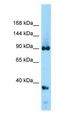 DDX20 / GEMIN3 Antibody - DDX20 / GEMIN3 antibody Western Blot of Rat Kidney. Antibody dilution: 1 ug/ml.  This image was taken for the unconjugated form of this product. Other forms have not been tested.