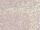 DDX20 / GEMIN3 Antibody - Immunohistochemistry of paraffin-embedded human tonsil tissue at dilution 1:100