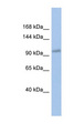 DDX24 Antibody - DDX24 antibody Western blot of OVCAR-3 cell lysate. This image was taken for the unconjugated form of this product. Other forms have not been tested.