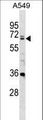 DDX28 Antibody - DDX28 Antibody western blot of A549 cell line lysates (35 ug/lane). The DDX28 antibody detected the DDX28 protein (arrow).