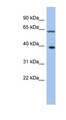 DDX3 / DDX3X Antibody - DDX3X antibody Western blot of THP-1 cell lysate. This image was taken for the unconjugated form of this product. Other forms have not been tested.