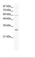 DDX31 Antibody - Jurkat Cell Lysate.  This image was taken for the unconjugated form of this product. Other forms have not been tested.