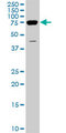 DDX3Y Antibody - DDX3Y monoclonal antibody (M01), clone 2D7. Western blot of DDX3Y expression in NIH/3T3.
