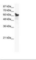 DDX41 / ABS Antibody - Jurkat Cell Lysate.  This image was taken for the unconjugated form of this product. Other forms have not been tested.
