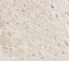DDX41 / ABS Antibody - Immunohistochemistry of DDX41 in rat brain tissue with DDX41 antibody at 2.5 ug/ml.