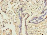 DDX42 Antibody - Immunohistochemistry of paraffin-embedded human lung using antibody at dilution of 1:100.