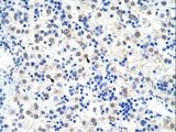 DDX47 Antibody - DDX47 antibody ARP41210_T100-NP_057439-DDX47 (DEAD (Asp-Glu-Ala-Asp) box polypeptide 47) Antibody was used in IHC to stain formalin-fixed, paraffin-embedded human liver.  This image was taken for the unconjugated form of this product. Other forms have not been tested.