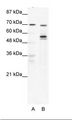 DDX55 Antibody - A: Marker, B: HepG2 Cell Lysate.  This image was taken for the unconjugated form of this product. Other forms have not been tested.